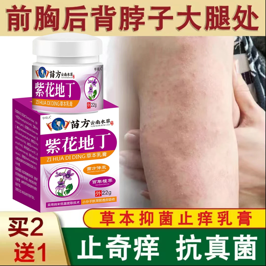 身上皮肤痒后背前胸手臂腿部痒起疙瘩小红点草本外用抑菌止痒乳膏