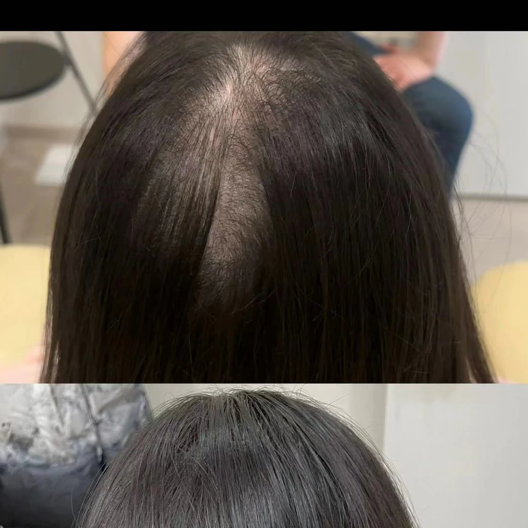顾客真实反馈对比 导液梳