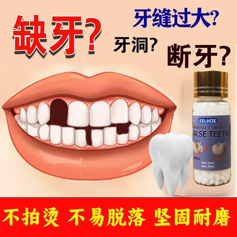补牙树脂修复材料自己动手牙齿补缺牙补牙缝假牙堵牙洞临时补牙胶