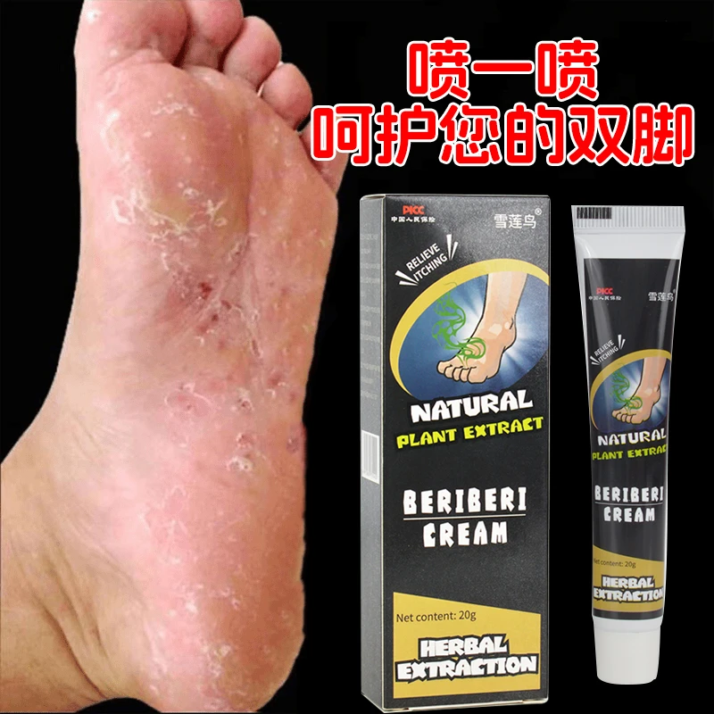 脚痒脚臭止痒膏去脚出汗脱皮起水泡干裂脚趾缝痒喷剂抑菌止痒神器