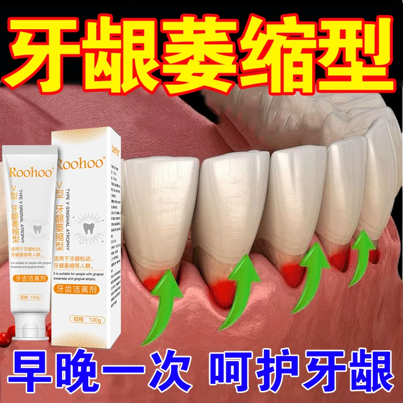 roohoo牙齿洁离剂牙龈萎缩松动人群适用