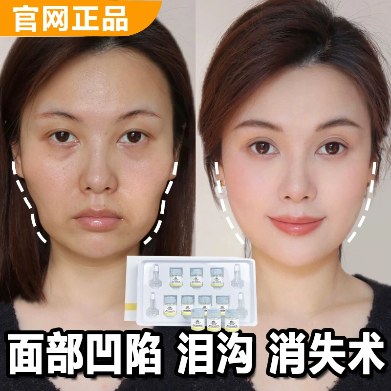面部丰盈精华液丰太阳穴法令纹泪沟凹陷填充修复神奇脸部圆润饱满