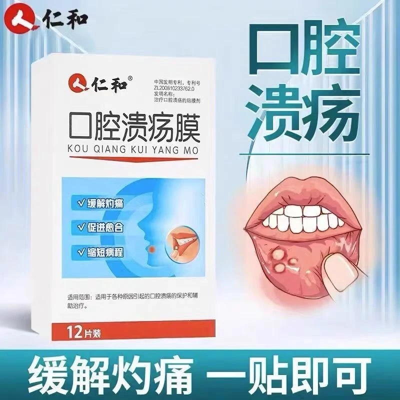 仁和口腔溃疡膜贴嘴巴舌头肿胀起泡儿童成人通用