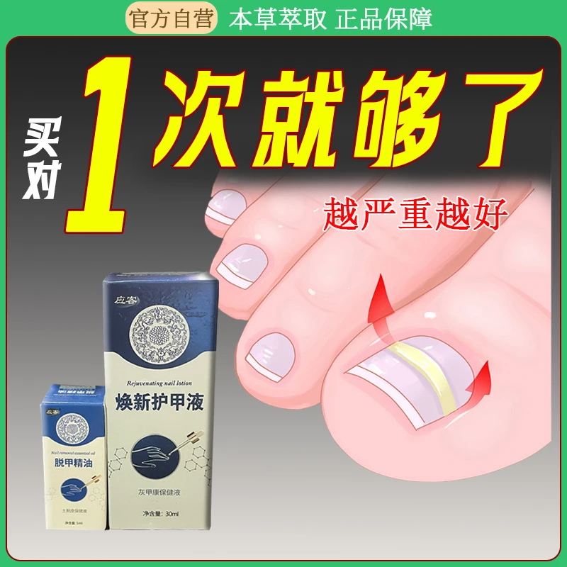 应客专用炎指甲往肉里长甲沟宁肌肤液脚趾甲手指甲男女甲沟液