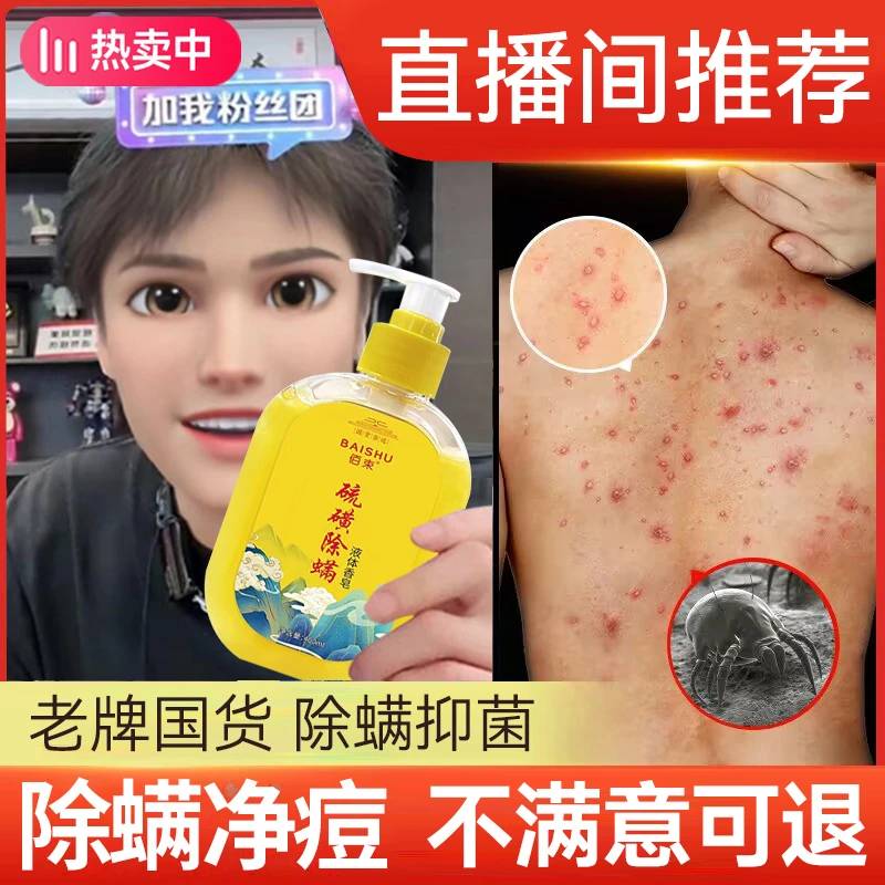 小扬哥推荐硫磺除螨皂控油祛痘沐浴露香皂硫磺药皂全身抑菌去螨虫