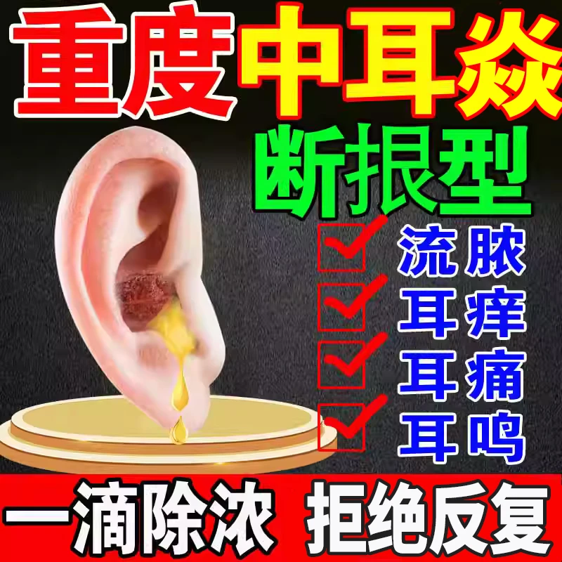 中耳焱耳朵消焱滴耳液中耳流脓耳鸣耳痒真菌感染止痒抑菌耳道清洗