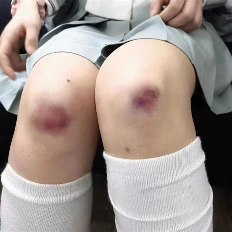 淤青伤病态美学伤疤纹身贴 万圣节派对妆容酒吧纹身逼真3D疤痕贴