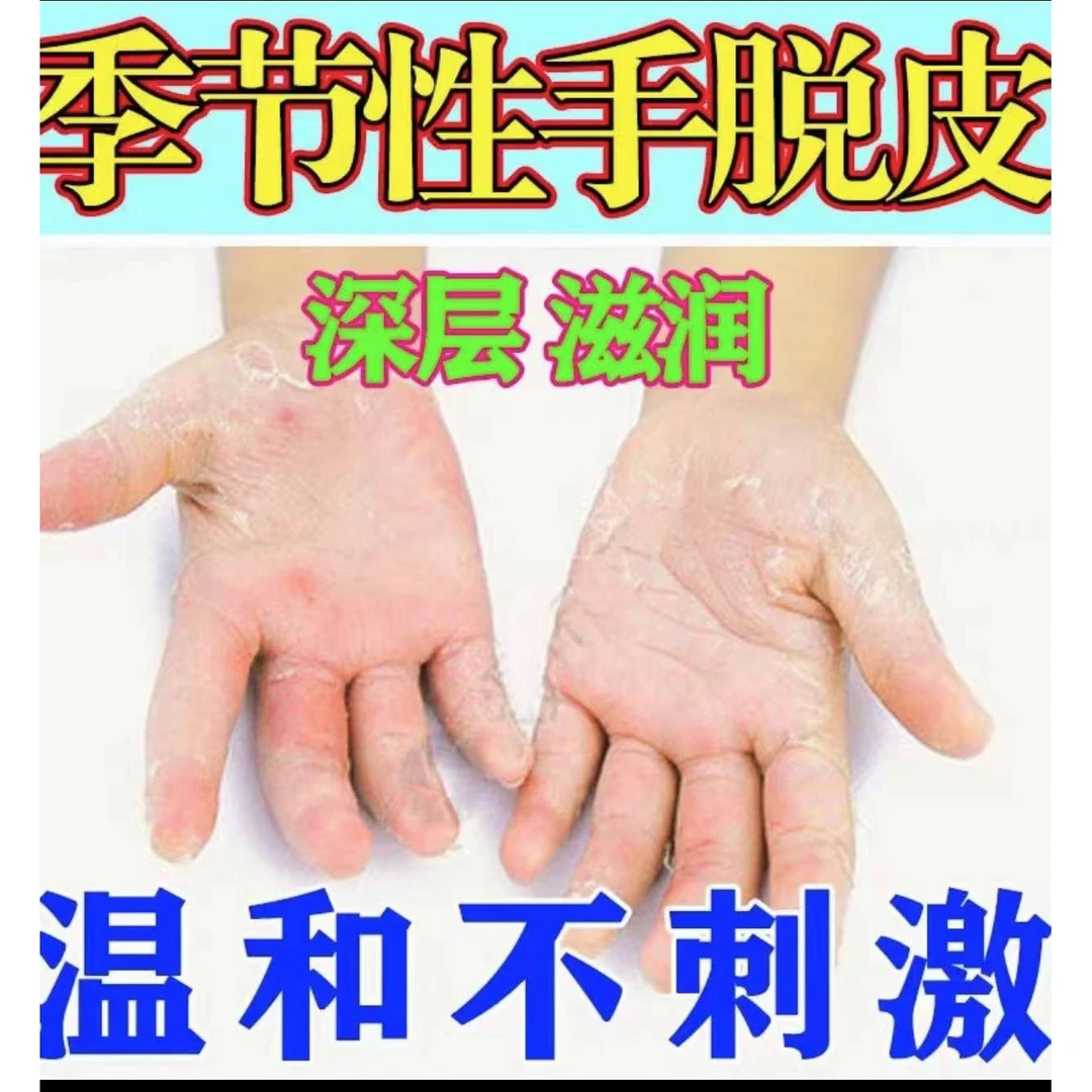 手指头脱皮起干皮手干裂手掌心脱皮起硬皮手足脱皮变硬外用发套餐