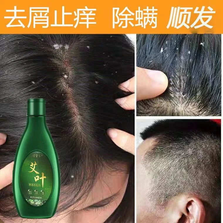 艾草洗发水去屑止痒控油去油蓬松养发固发修护滋养头皮男女通用