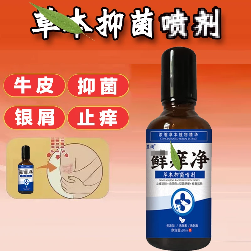 牛皮银屑抑菌止痒擦剂50ml