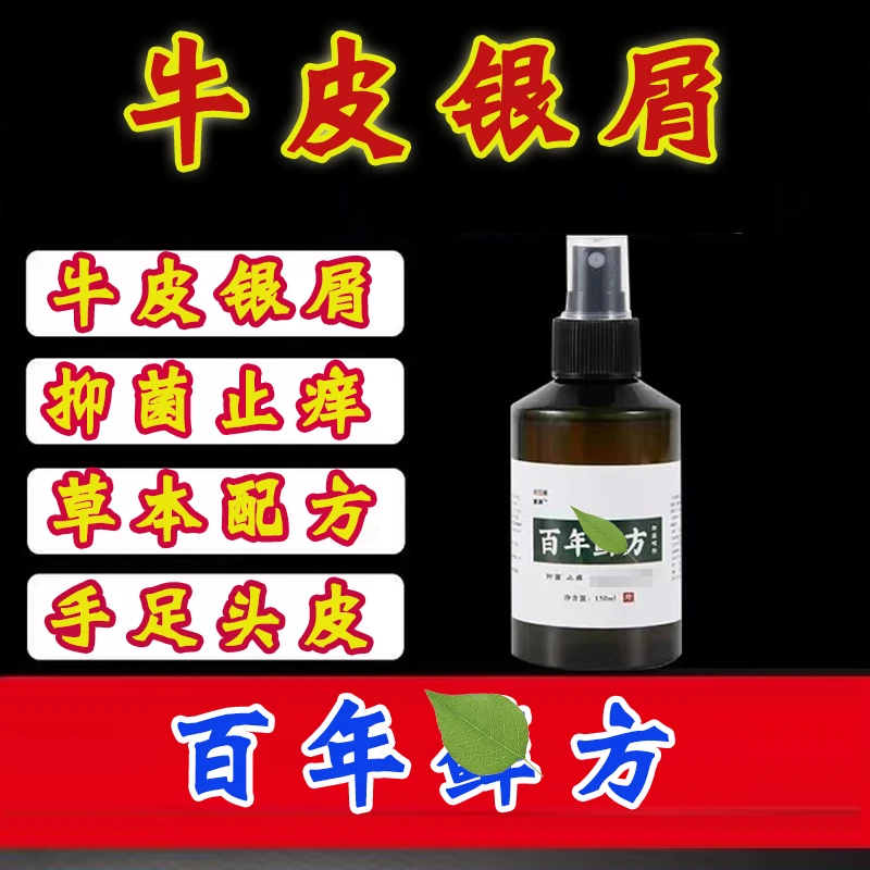 牛皮银屑外用喷剂150ml