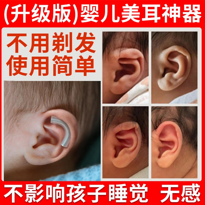 日本新生儿耳朵矫正器婴儿耳廓贴畸形纠正塑形外垂定型招风耳宝宝