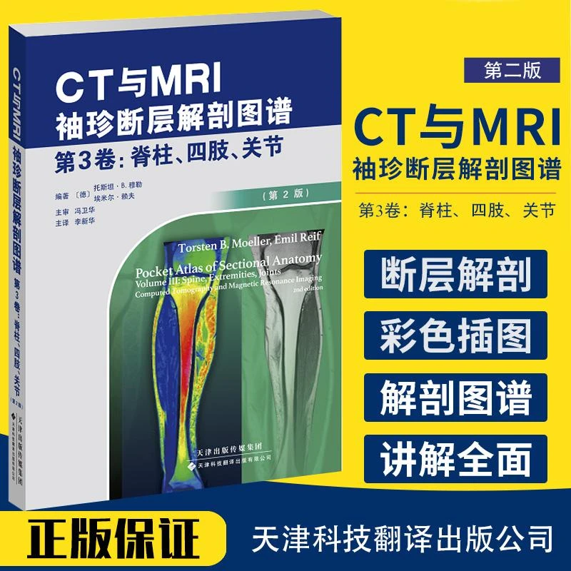 CT与MRI袖珍断层解剖图谱.第3卷 脊柱 四肢 关节 高清CT/MRI图像