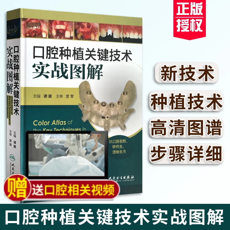 包邮 正版现货 口腔种植关键技术实战图解(谭震供口腔医师、研究