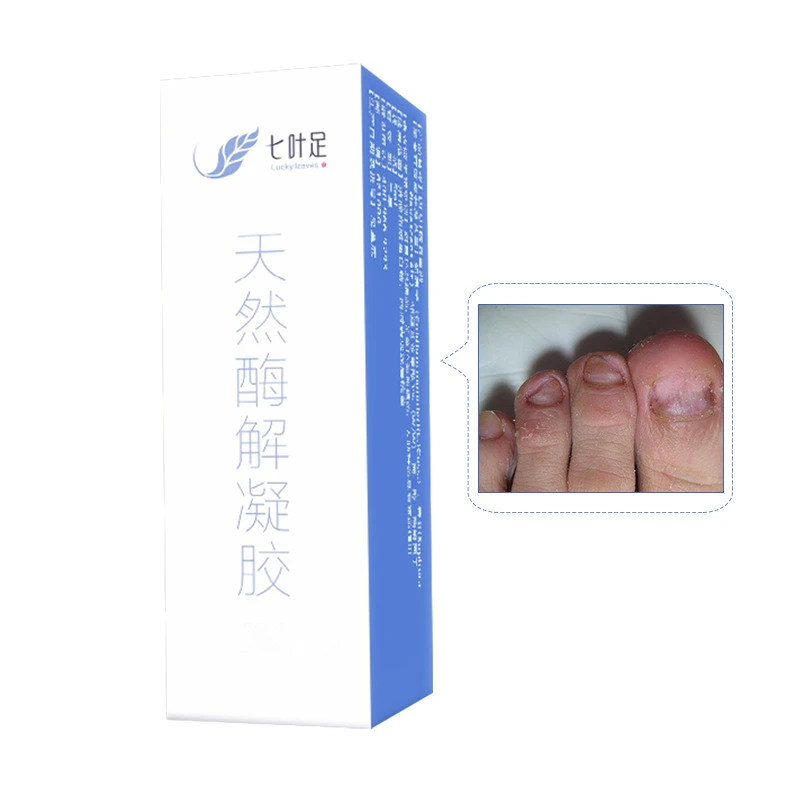 脱甲液软甲美甲护理灰黄厚指甲修护套装组合