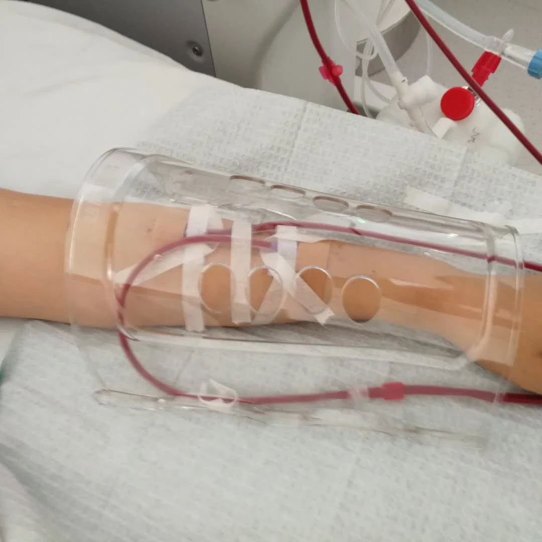 朗腾 穿刺胳膊内瘘专用保护罩防护罩内瘘保护套透析病人用品防水