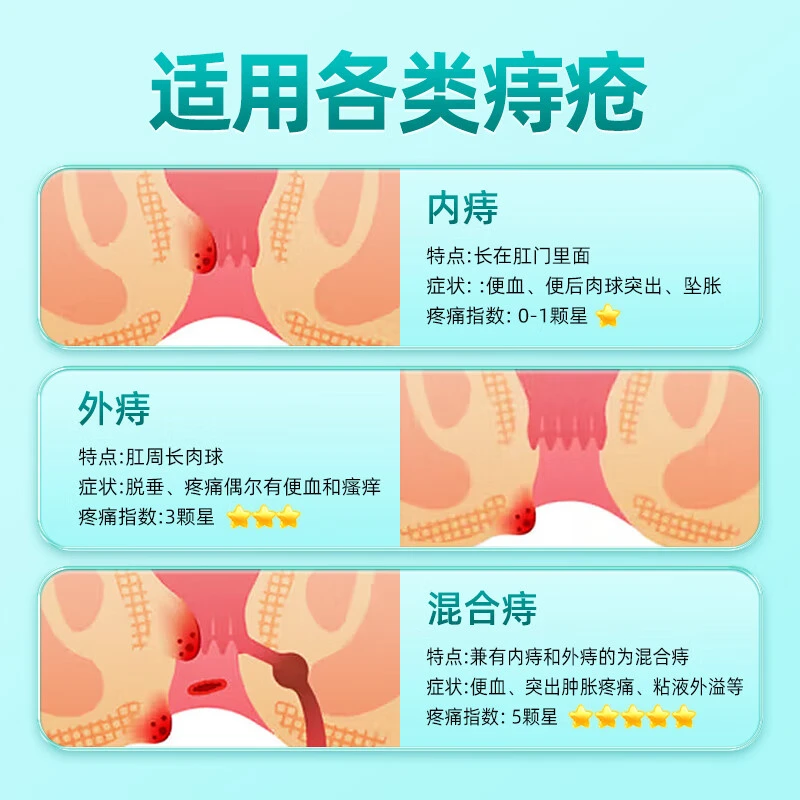 内廷上用壳聚糖痔疮凝胶肛门瘙痒混合痔内外肉球男女专用痔疮膏