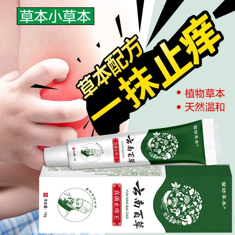 云南草本真菌感染痒止痒王水泡手痒止痒膏手指痒手上起小水泡很痒