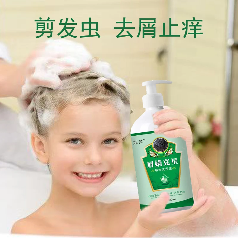 儿童剪发虫成人去屑止痒除螨洗发水卷发虫断发虫洗液