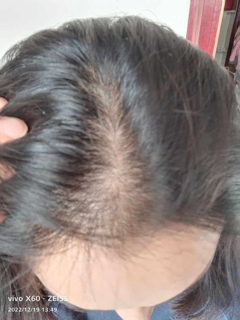 92年宝妈真实反馈对比图 梳子