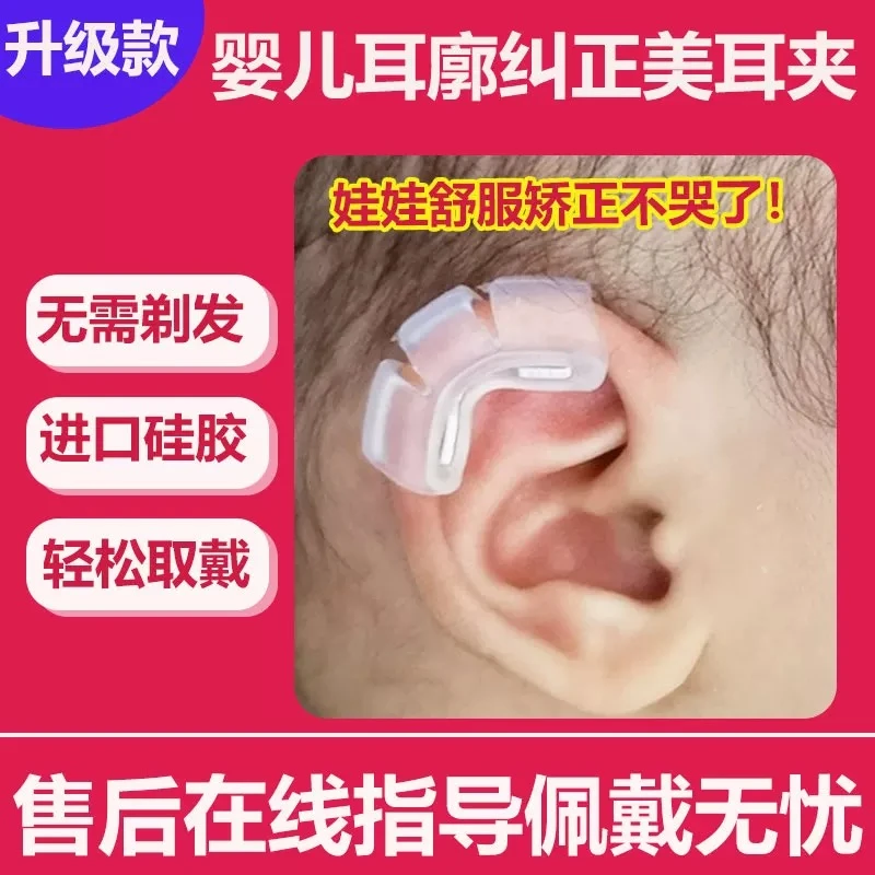 婴儿耳廓矫正器宝宝新生耳朵定型招风耳塑形硅胶带耳畸形耳撑耳夹