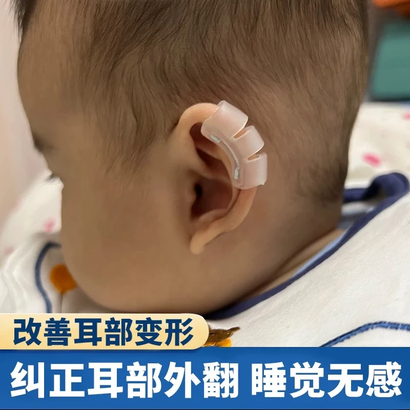 婴儿耳朵矫正器新生儿耳廓撑硅胶耳夹纠正婴儿耳朵压扁矫正神器