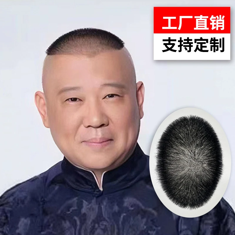 【生物头皮真发补发片】男士郭德纲发型光头专用超薄假发片发块毛M