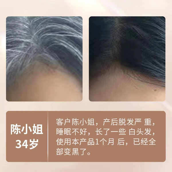藏红花对白发的效果展示
