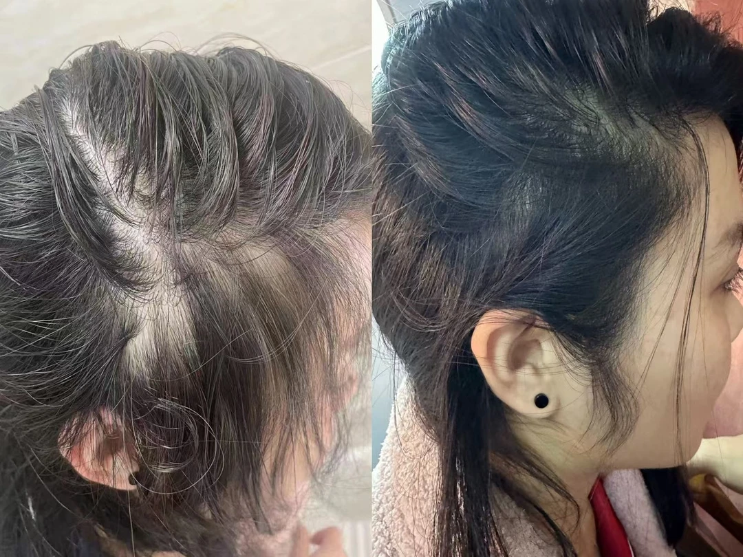 娟子照片看这里  木梳