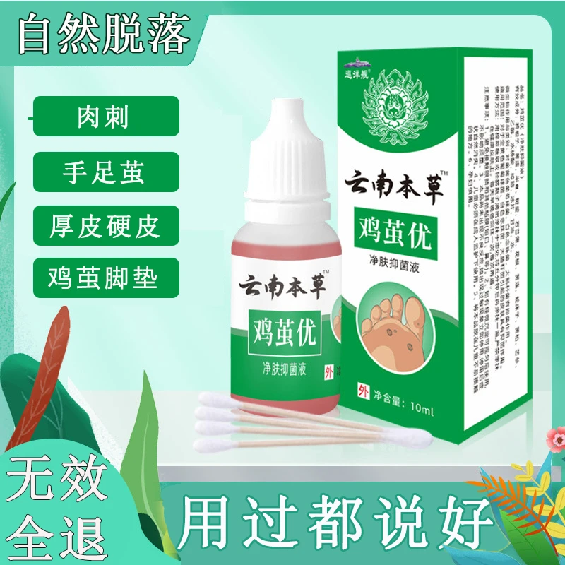 茧喷剂清祛老茧脚垫脚后跟硬皮鸡茧膏软化手脚厚茧除关节茧去死皮