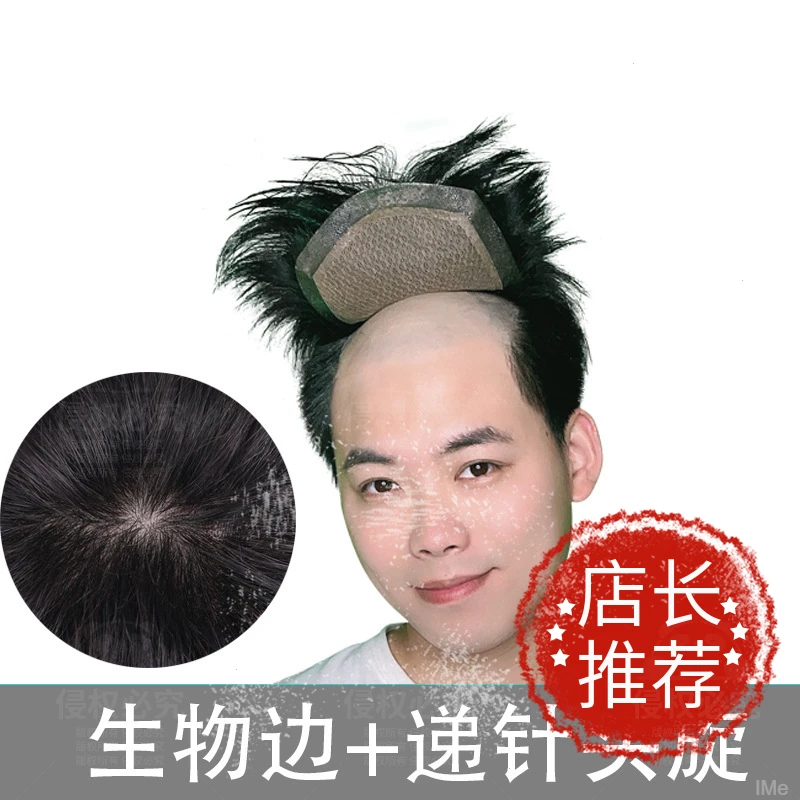 男士假发递针头旋款全手织递针旋生物头皮边秃顶地中海假发男发片