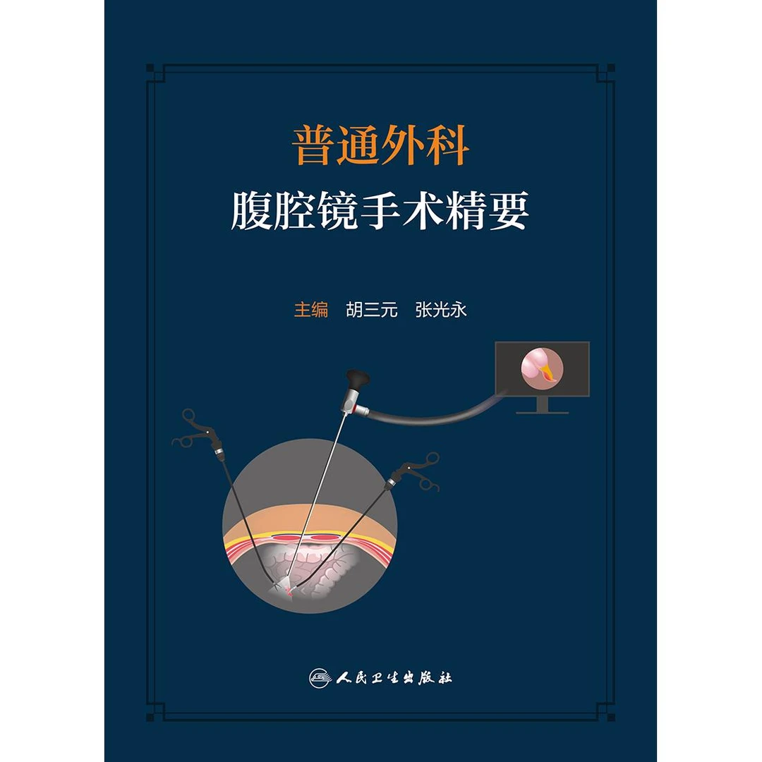 普通外科腹腔镜手术精要