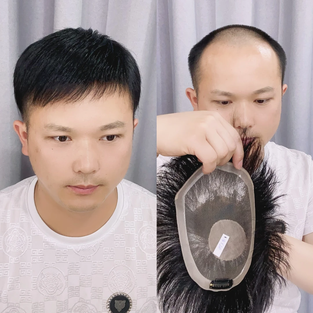 六安速美男士假发片透气