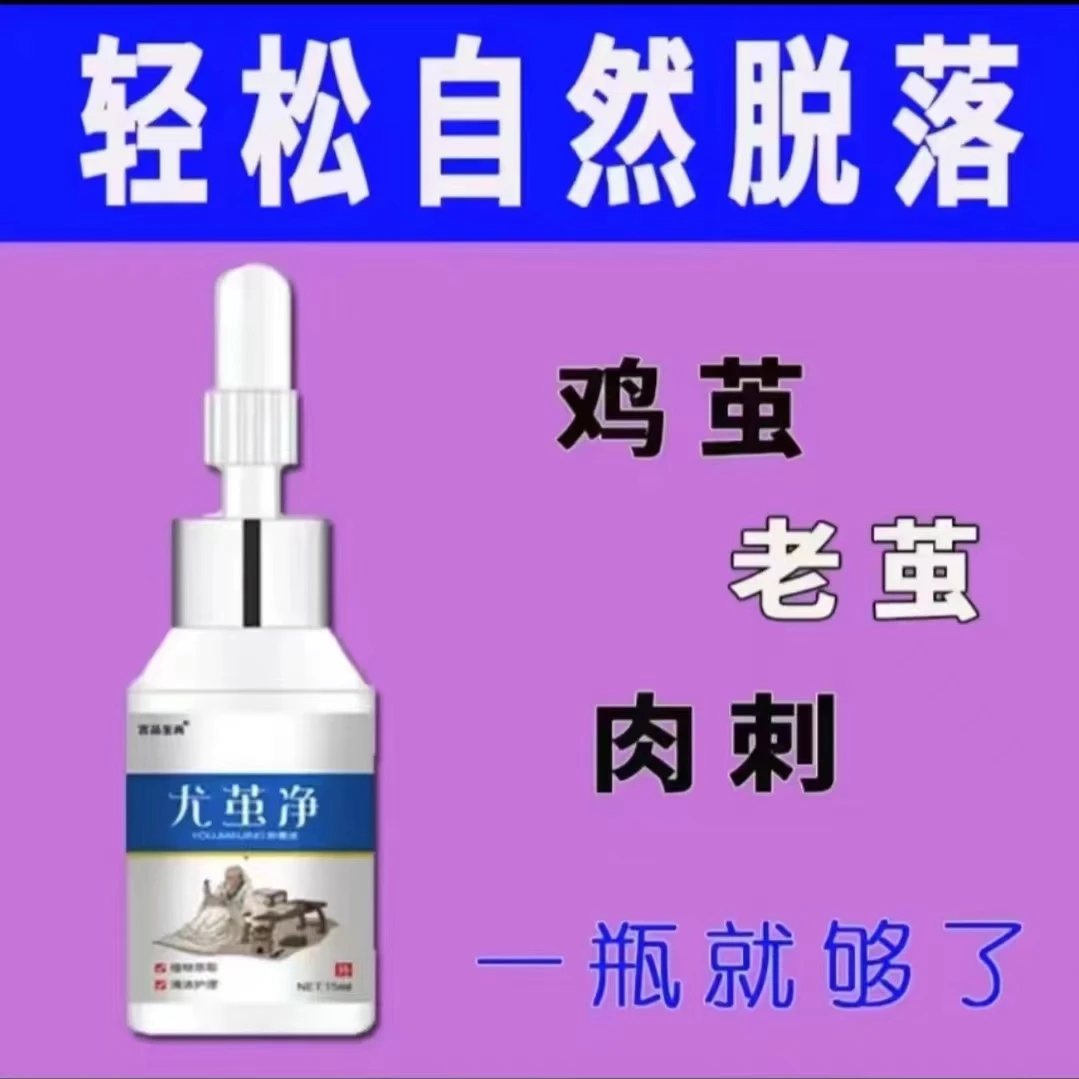 尤茧霸去老茧厚茧手茧鸡茧脚垫老皮肉刺硬皮死皮云南脚部护理本草