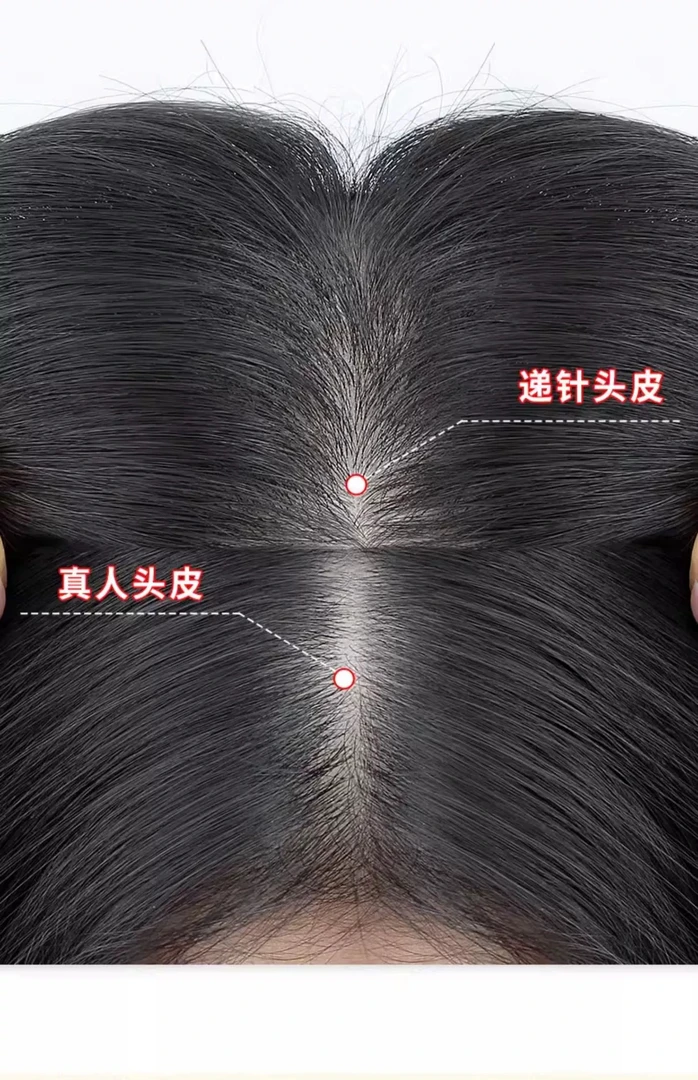【超薄递针头皮头塌拍】9*14更薄更透气超逼真女士头顶补发片