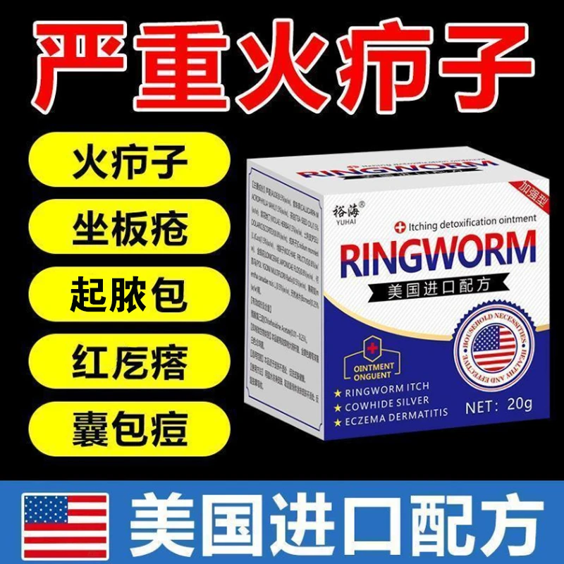 【不好包褪】火疖子拔毒进口火疙瘩屁股硬块坐板疮外用涂抹身体护