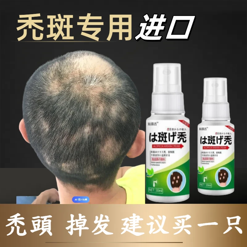 秃头喷剂掉头发严重班禿秃顶头发稀少禿斑护理喷剂草本身体护理