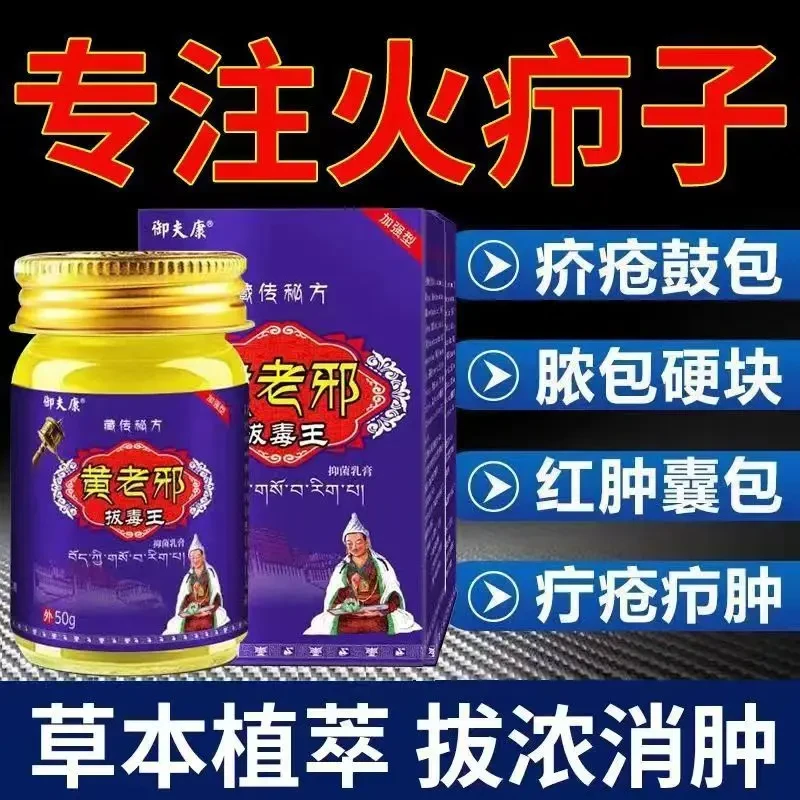 黄老邪火疖子拔毒进口疙瘩屁股硬块坐板疮外用涂抹特效乳身体护理