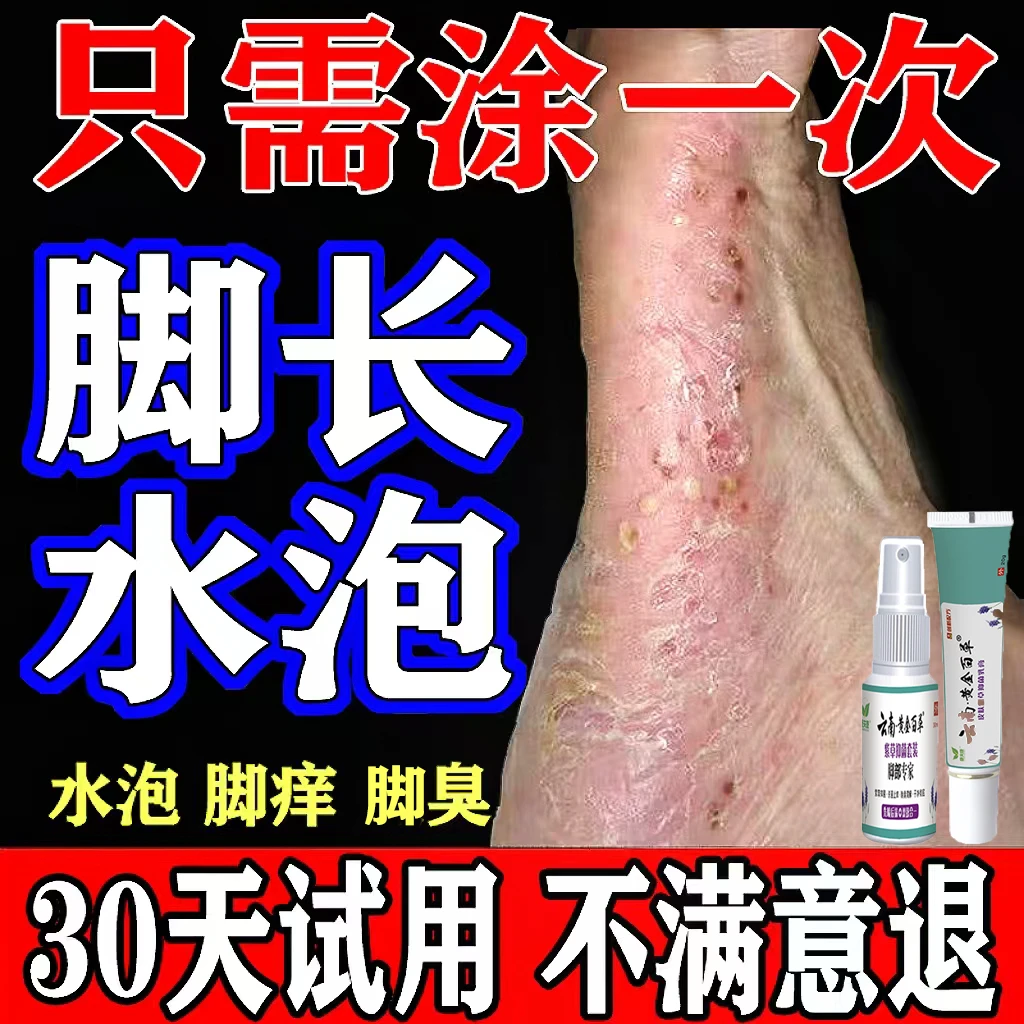 脚起水泡痒脱皮脚趾缝脚臭气真菌王杀抑菌止痒喷雾剂特效克星神器