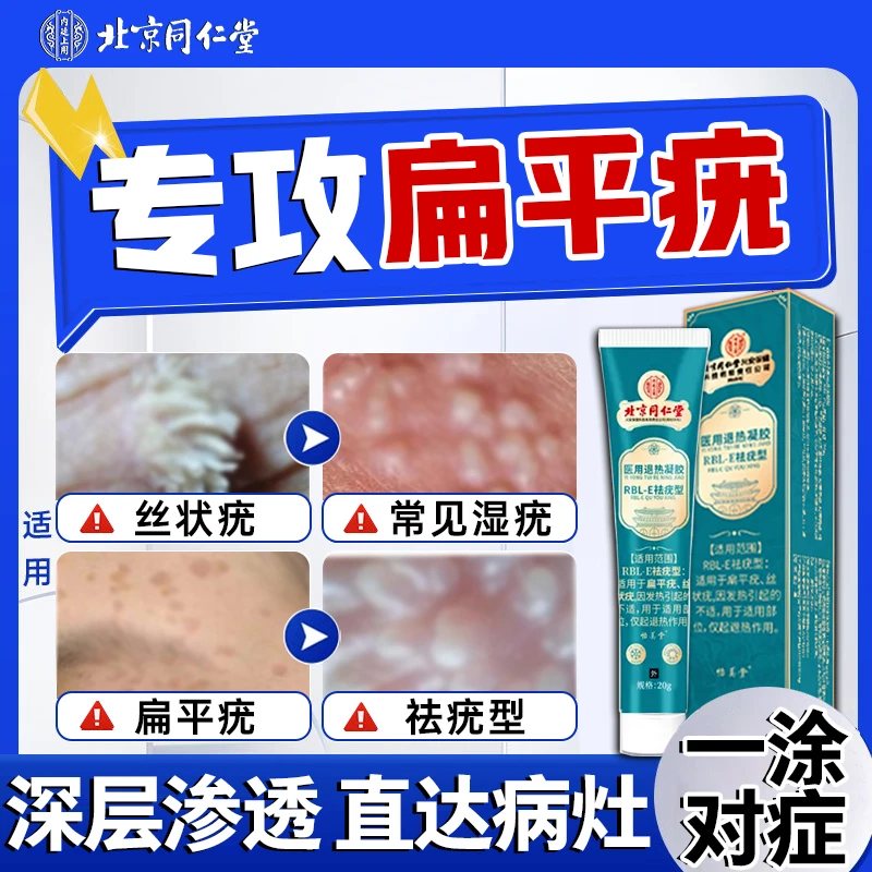 北京同仁堂扁平疣怎么去疣专用乳膏丝状疣专用乳膏疣体膏脖子上长小肉揪揪是怎么回事去肉粒疙瘩医用退热凝胶祛疣型内廷上用