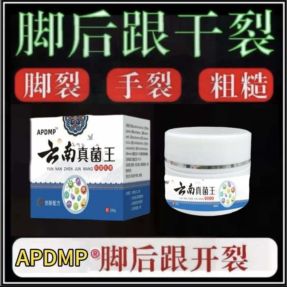 正品云南真菌王脚后跟起皮粗糙干裂起硬皮手开口干裂防裂膏足霜