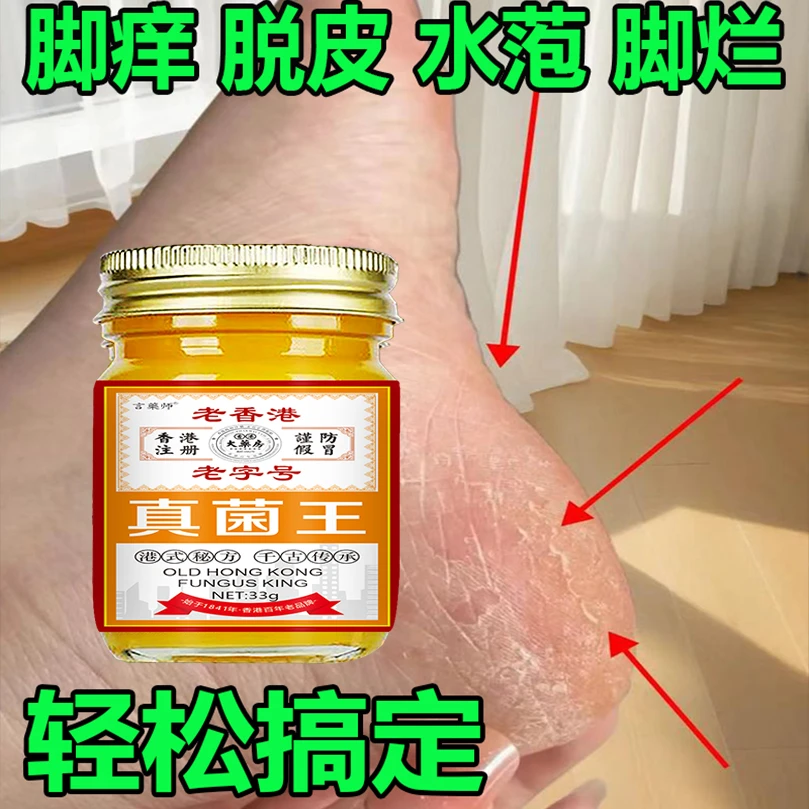 【正品真菌王】脚痒脚臭起水泡脚缝痒脱皮香港脚脱脚底痒抑菌止痒