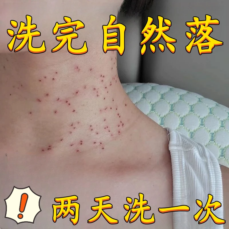 【正品国货】身上干干净净 不留痕迹