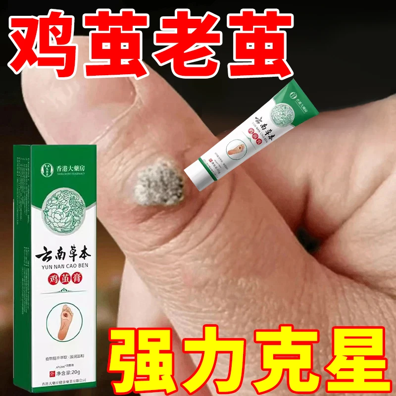 脚钉去除液去老茧神器手脚上脚趾鸡厚皮茧脚底脚垫去老茧软化剂