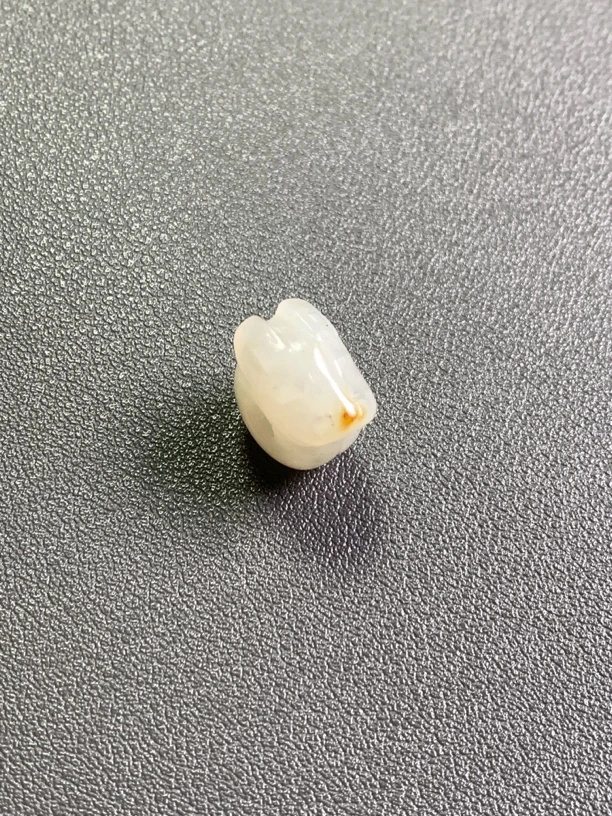 红山白玉黄沁玉猪龙