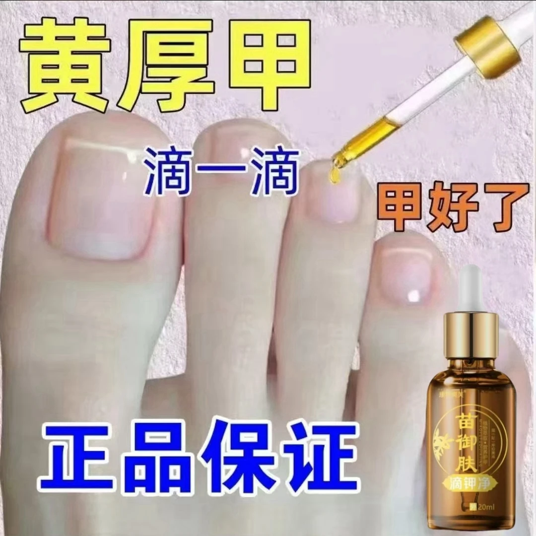 趾甲脚指甲专用抑菌液趾甲复抑菌液指甲专用抑菌液草本萃取