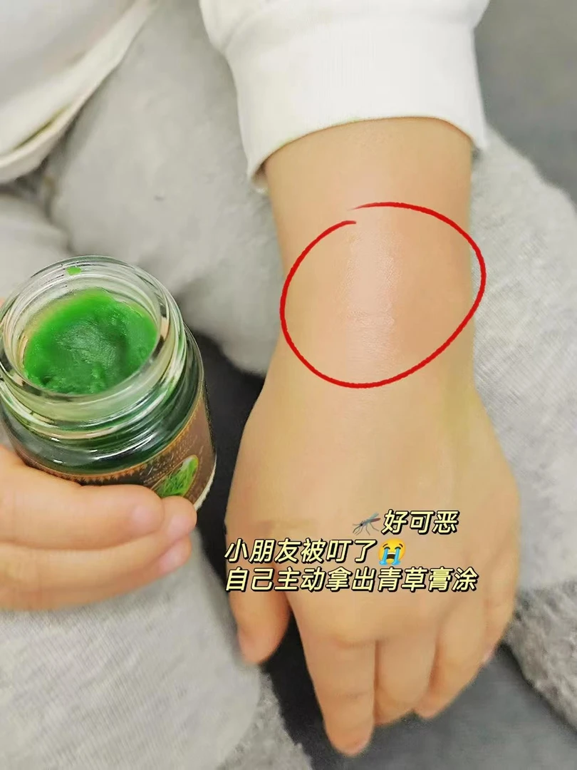 家庭必备四季常用青草膏