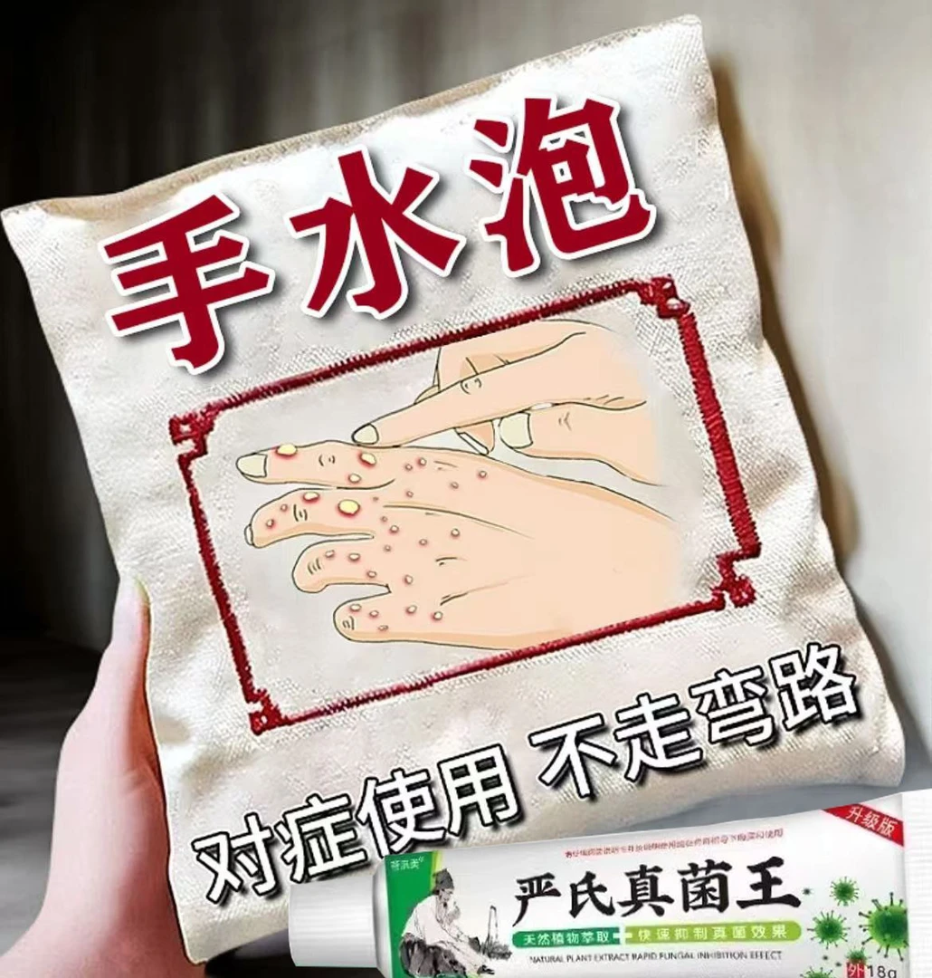 手上起小水泡疙瘩痒身上红点疙瘩痒抑菌止痒膏