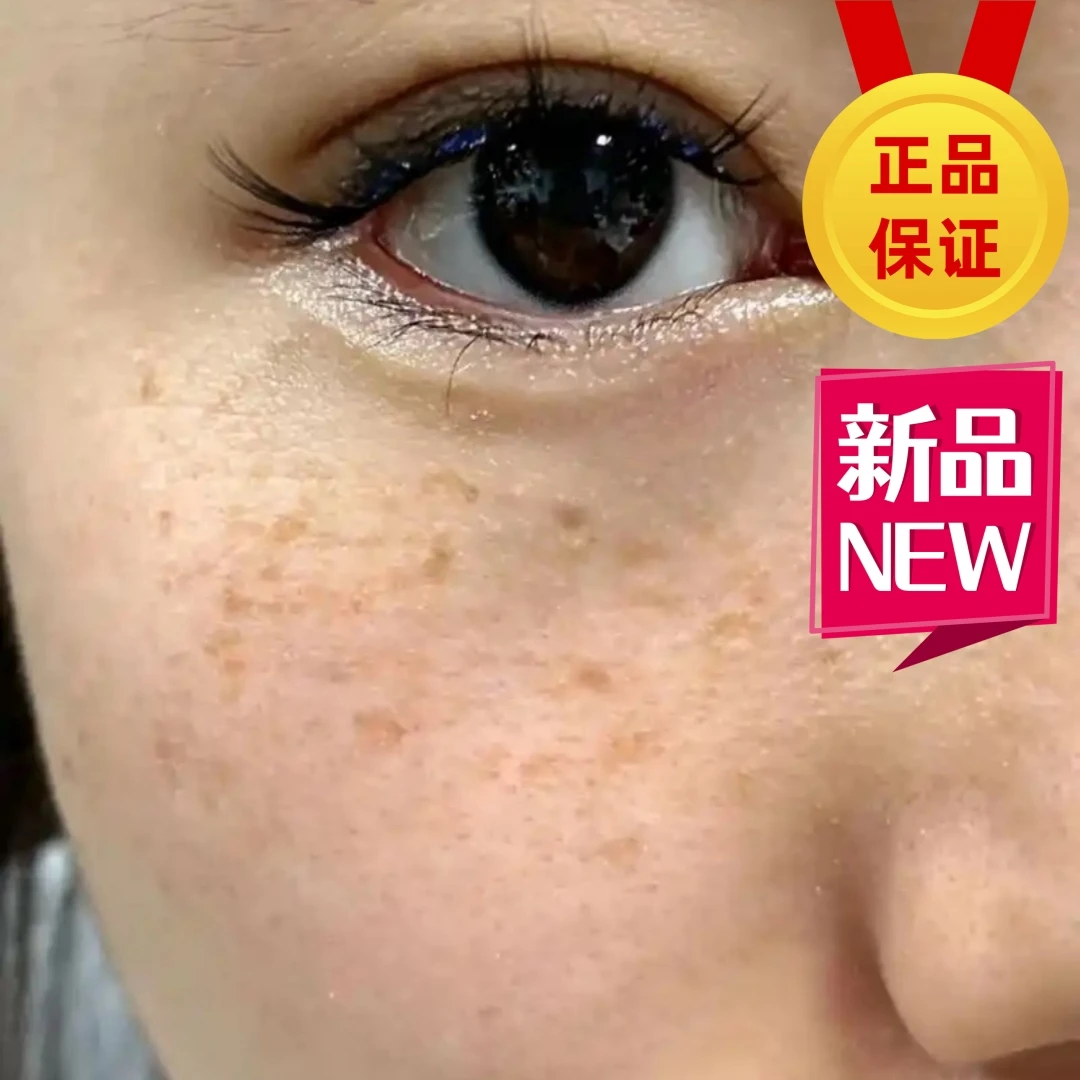 ZZ77-面膜-暗沉提亮肤色透亮去黄-美-白-袪-斑男女5-80岁可用