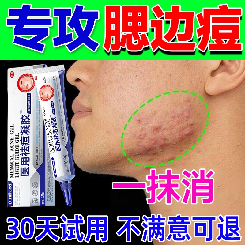德国腮边痘下颚线专用下巴硬块痘痘祛痘凝胶